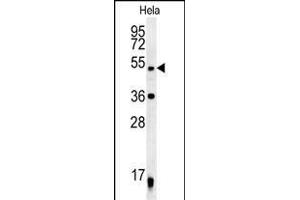 DDX47 Antibody (C-term) (ABIN652169 and ABIN2840575) western blot analysis in Hela cell line lysates (35 μg/lane). (DDX47 Antikörper  (C-Term))