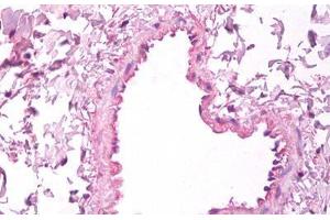 Anti-VEGF antibody IHC staining of human lung, vascular endothelium. (VEGFA Antikörper)