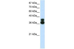 WB Suggested Anti-FOXJ1 Antibody Titration:  0.