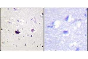 Immunohistochemistry analysis of paraffin-embedded human brain tissue, using PAK1/2/3 (Ab-144/141/139) Antibody. (PAK1/2/3 Antikörper  (AA 111-160))