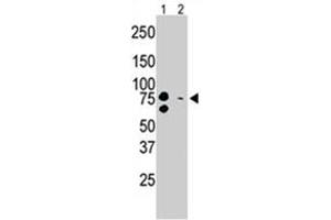 The BRD3 polyclonal antibody  is used in Western blot to detect BRD3 in mouse brain tissue lysate (Lane 1) and Sacs-2 cell lysate. (BRD3 Antikörper  (C-Term))