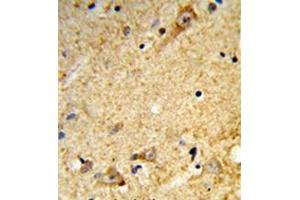 Immunohistochemistry analysis in formalin-fixed and paraffin-embedded human brain tissue reacted with Tricellulin Antibody (C-term) followed which was peroxidase-conjugated to the secondary antibody, followed by DAB staining.