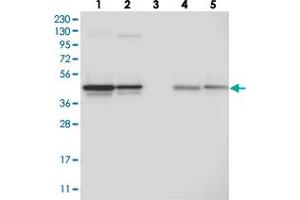 Western blot analysis of Lane 1: RT-4, Lane 2: U-251 MG, Lane 3: Human Plasma, Lane 4: Liver, Lane 5: Tonsil with CCBL2 polyclonal antibody  at 1:250-1:500 dilution. (CCBL2 Antikörper)