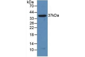 Detection of Recombinant NFkB2, Human using Polyclonal Antibody to Nuclear Factor Kappa B2 (NFkB2) (Nuclear Factor kappa B2 (AA 38-343) Antikörper)
