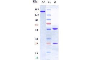 Anti-CD28 Reference Antibody (FR104) on SDS-PAGE under reducing (R) condition.
