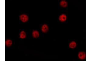 ABIN6274379 staining COLO205 cells by IF/ICC.