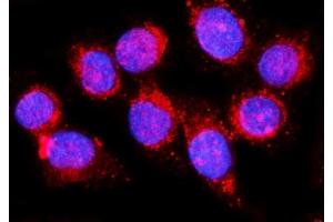 IF analysis of EHD1 using anti-EHD1 antibody (ABIN7602880).