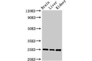 Western Blot Positive WB detected in: Mouse brain tissue, Mouse liver tissue, Mouse kidney tissue All lanes: VAMP7 antibody at 2 μg/mL Secondary Goat polyclonal to rabbit IgG at 1/50000 dilution Predicted band size: 25, 31, 21 kDa Observed band size: 25 kDa (VAMP7 Antikörper  (AA 2-186))