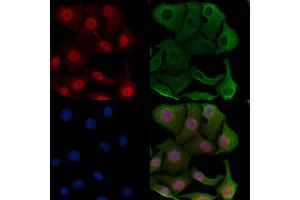 ABIN7094565 and ABIN7098614 staining Hela cells by IF/ICC. (SMG6 Antikörper  (N-Term))