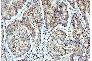 IHC analysis of SAE2/UBA2 using anti-SAE2/UBA2 antibody (ABIN7601755).