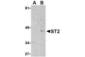 Image no. 1 for anti-Interleukin 1 Receptor-Like 1 (IL1RL1) (N-Term) antibody (ABIN206539) (IL1RL1 Antikörper  (N-Term))