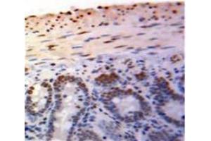 IHC-P analysis of Bowels tissue, with DAB staining. (PML Antikörper  (AA 59-239))