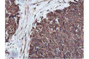 Image no. 4 for anti-Proteasome (Prosome, Macropain) Subunit, beta Type, 7 (PSMB7) (AA 58-277) antibody (ABIN1491598)