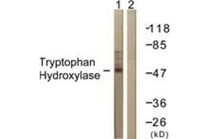 Western blot analysis of extracts from Jurkat cells, using Tryptophan Hydroxylase (Ab-260) Antibody. (Tryptophan Hydroxylase 1 Antikörper  (AA 231-280))