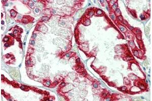 Kidney, Human: Formalin-Fixed, Paraffin-Embedded (FFPE) (Cytokeratin 18 Antikörper)