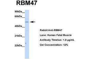 Host: Rabbit  Target Name: RBM47  Sample Tissue: Human Fetal Muscle  Antibody Dilution: 1. (RBM47 Antikörper  (Middle Region))