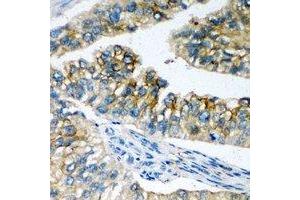 Immunohistochemical analysis of NBC1 staining in human prostate formalin fixed paraffin embedded tissue section. (SLC4A4 Antikörper)