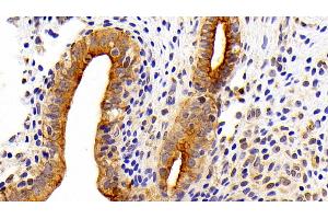 Detection of CK7 in Rat Uterus Tissue using Polyclonal Antibody to Cytokeratin 7 (CK7) (Cytokeratin 7 Antikörper  (AA 394-457))