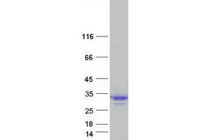 Western Blotting (WB) image for Myelin Protein Zero-Like 2 (MPZL2) (Transcript Variant 2) protein (Myc-DYKDDDDK Tag) (ABIN2726310)
