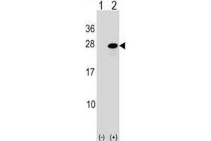 Western Blotting (WB) image for anti-Activating Transcription Factor 3 (ATF3) antibody (ABIN2998842)