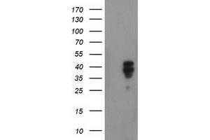 Western Blotting (WB) image for anti-NudE Nuclear Distribution E Homolog (A. Nidulans)-Like 1 (NDEL1) antibody (ABIN1499851) (NDEL1 Antikörper)