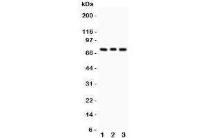 Western blot testing of PKC beta antibody and Lane 1:  rat brain;  2: mouse brain;  3: human COLO320.