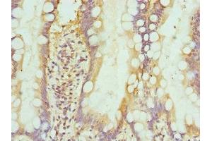 Immunohistochemistry of paraffin-embedded human small intestine tissue using ABIN7156393 at dilution of 1:100 (INTS1 Antikörper  (AA 451-710))
