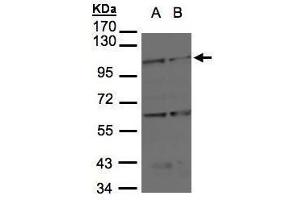WB Image Sample(30 μg of whole cell lysate) A:H1299 B:Raji , 7. (BMPR2 Antikörper  (C-Term))