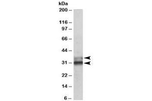 Western blot testing of human colon lysate with ETFA antibody at 0. (ETFA Antikörper)