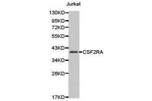 Western Blotting (WB) image for anti-Colony Stimulating Factor 2 Receptor, Alpha, Low-Affinity (Granulocyte-Macrophage) (CSF2RA) antibody (ABIN1872028) (CSF2RA Antikörper)