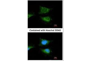 ICC/IF Image Immunofluorescence analysis of methanol-fixed HeLa, using GBA, antibody at 1:100 dilution. (GBA Antikörper  (C-Term))