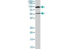 MECP2 monoclonal antibody (M01), clone 4B6. (MECP2 Antikörper  (AA 81-170))