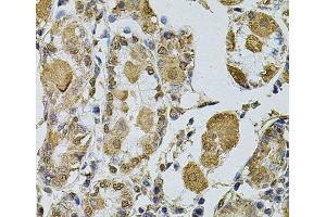 Immunohistochemistry of paraffin-embedded Human stomach using Cyclin A2 Polyclonal Antibody at dilution of 1:100 (40x lens). (Cyclin A Antikörper)
