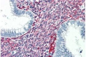 Human Uterus (formalin-fixed, paraffin-embedded) stained with SERPINH1 antibody ABIN364502 at 5 ug/ml followed by biotinylated anti-mouse IgG secondary antibody ABIN481714, alkaline phosphatase-streptavidin and chromogen.