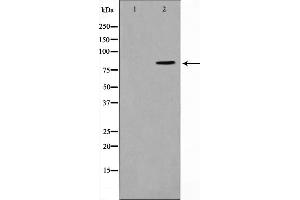 Western blot analysis of STAT1 expression in COLO205 whole cell lysates,The lane on the left is treated with the antigen-specific peptide. (STAT1 Antikörper)