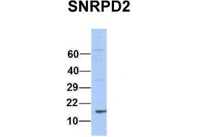 Host:  Rabbit  Target Name:  SNRPD2  Sample Type:  Human 293T  Antibody Dilution:  1. (SNRPD2 Antikörper  (Middle Region))