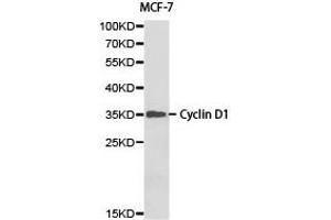Western blot analysis of MCF-7 cell lysate ,using Cyclin D1 antibody. (Cyclin D1 Antikörper)