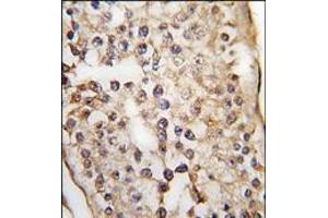 Formalin-fixed and paraffin-embedded human testis tissue reacted with PUM1 Antibody (C-term), which was peroxidase-conjugated to the secondary antibody, followed by DAB staining. (PUM1 Antikörper  (N-Term))