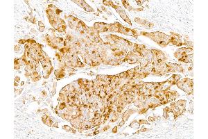 Immunohistochemistry (IHC) image for anti-Uroplakin 3A (UPK3A) antibody (ABIN7795600)