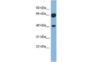 WB Suggested Anti-RAB3IL1 Antibody Titration: 0. (RAB3IL1 Antikörper  (Middle Region))