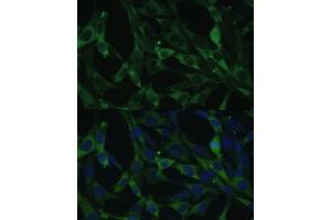 Immunofluorescence analysis of NIH-3T3 cells using CALU antibody (ABIN6129533, ABIN6137878, ABIN6137880 and ABIN6222201) at dilution of 1:100. (CALU Antikörper  (AA 20-315))