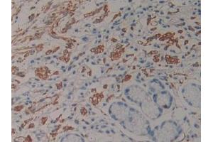 Immunohistochemistry (IHC) image for anti-Pro-Atrial Natriuretic Peptide (PRO-ANP) (AA 25-123) antibody (ABIN7431869)