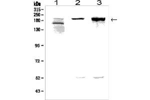 Western blot analysis of AGRN using anti-AGRN antibody (ABIN7600387). (AGRN Antikörper  (AA 1864-2068))
