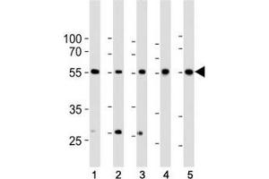 Western blot analysis of lysate from 1) HeLa, 2) K562, 3) MCF-7 cell line, 4) human liver and 5) mouse liver tissue lysate using BMPR1A antibody at 1:1000. (BMPR1A Antikörper  (AA 1-30))