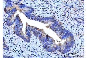 IHC analysis of RPS5 using anti-RPS5 antibody (ABIN7599076). (RPS5 Antikörper  (AA 1-204))