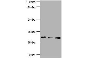 Western blot All lanes: Homeobox protein Hox-B5 antibody at 8 μg/mL Lane 1: HepG2 whole cell lysate Lane 2: Rat liver tissue Lane 3: Rat lung tissue Secondary Goat polyclonal to rabbit IgG at 1/10000 dilution Predicted band size: 29 kDa Observed band size: 29 kDa (HOXB5 Antikörper  (AA 1-170))