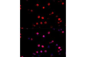 Immunofluorescence analysis of R. (PD-L1 Antikörper  (AA 19-238))