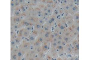 Immunohistochemistry (IHC) image for anti-TNF Receptor Superfamily, Member 6 (FAS) (AA 26-173) antibody (ABIN1078008)