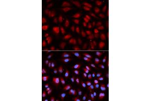 Immunofluorescence analysis of U2OS cells using PLK1 antibody.