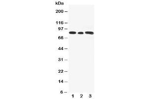 Western blot testing of Gli3 antibody and Lane 1:  rat testis